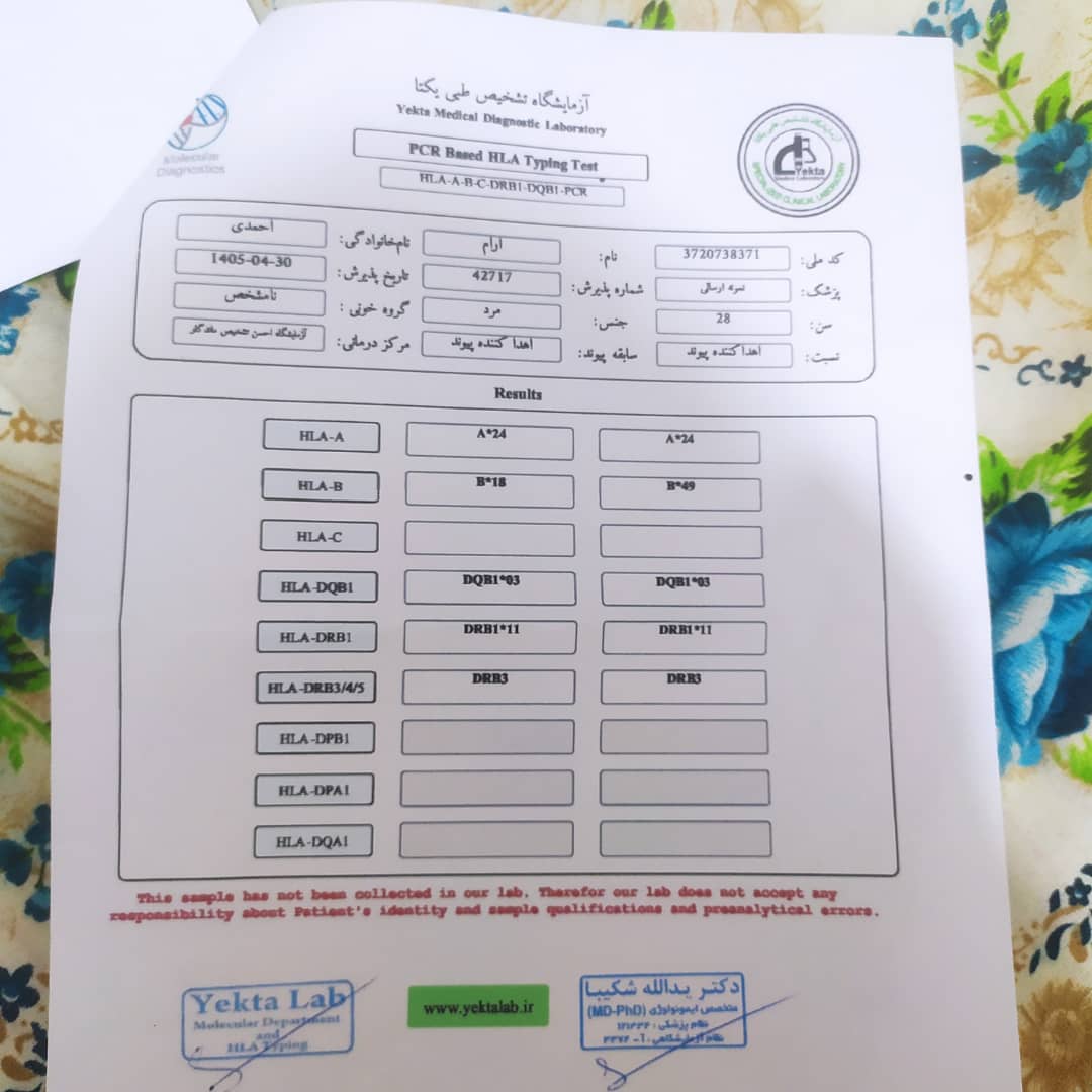 آزمایش HLA