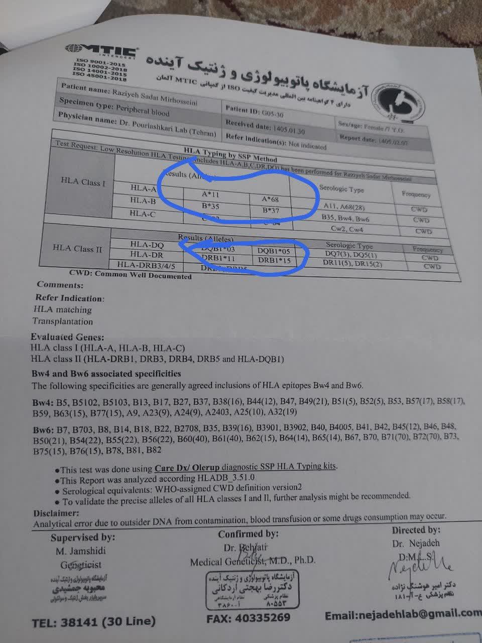 آزمایش HLA